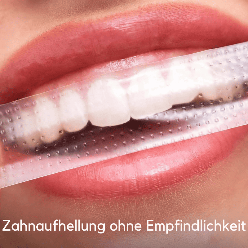 SmileKit – Komplette Zahnaufhellung in 30 Minuten