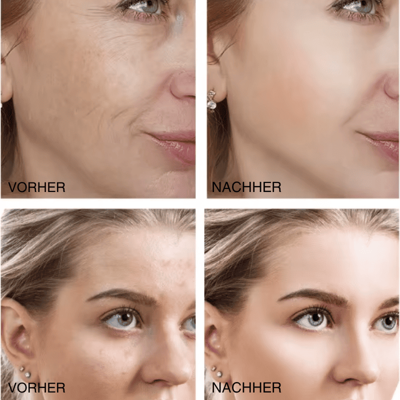 Retinol DermActive – Straffheit, Ausstrahlung und Jugend