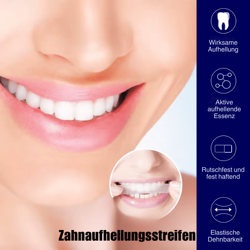 SmileKit – Komplette Zahnaufhellung in 30 Minuten