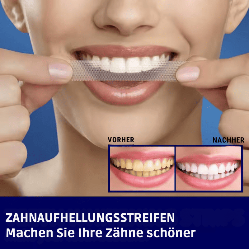 SmileKit – Komplette Zahnaufhellung in 30 Minuten