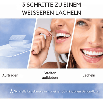 SmileKit – Komplette Zahnaufhellung in 30 Minuten